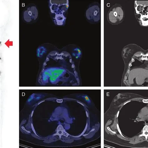 Can a pet scan be false