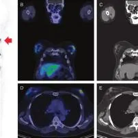 Can a pet scan be false?