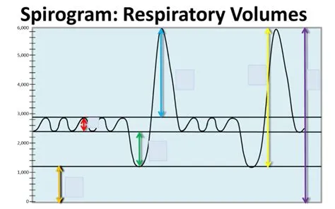 What is spirogram