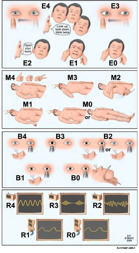 What is the best response to e4