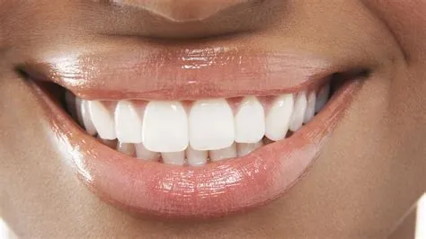 Should you smile with teeth in photos