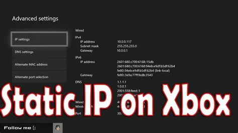 Should i give my xbox a static ip