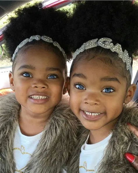 Can black babies have blue eyes