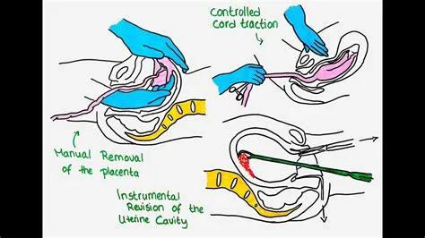 Why did they remove yennefers uterus